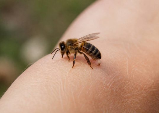 Abeille pique ou pas : tout savoir sur les risques et les interventions rapides