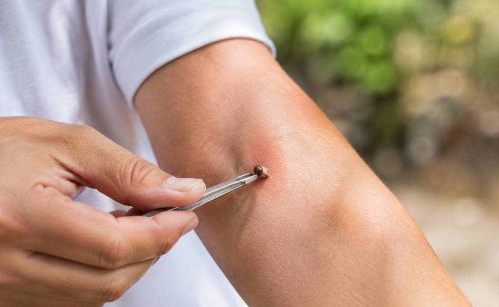 Soigner une piqure d’abeille : gestes et précautions à connaître