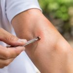 Soigner une piqure d’abeille : gestes et précautions à connaître